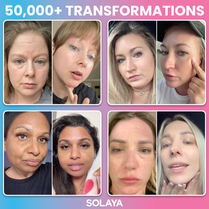 Solaya Collagen 14in1 Supplement [Free Today]