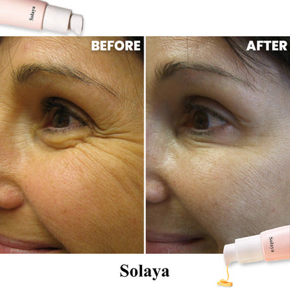 Solaya™ Eye Serum [Free Today]