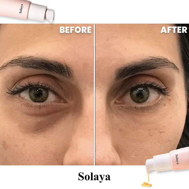 Solaya™ Eye Serum [Free Today]