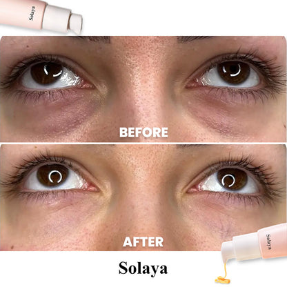 Solaya™ Eye Serum [Free Today]
